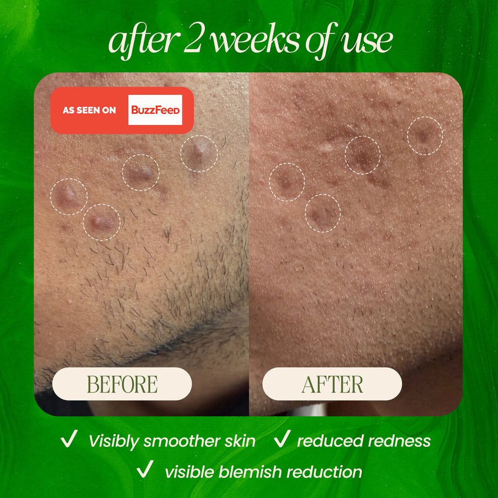 Bamboo Microdermabrasion Exfoliating Cleanser